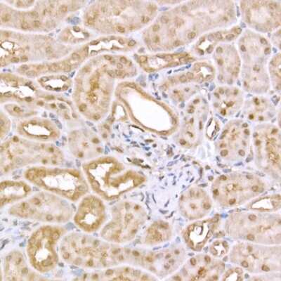 Immunohistochemistry-Paraffin: AMPK alpha 1/2 Antibody - Azide and BSA Free [NBP3-05628]
