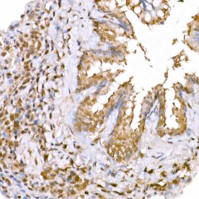 Immunohistochemistry-Paraffin: AMPK alpha 1/2 Antibody - Azide and BSA Free [NBP3-05628]