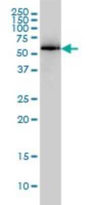 Western Blot: AMPK alpha 1 Antibody (1G4) [H00005562-M01]