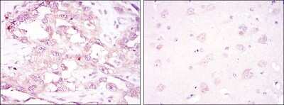Immunohistochemistry: AMPK alpha 1 Antibody (2B7) - Azide and BSA Free [NBP2-80575]