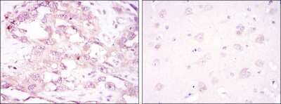 Immunohistochemistry-Paraffin: AMPK alpha 1 Antibody (2B7) - BSA Free [NBP2-22127]