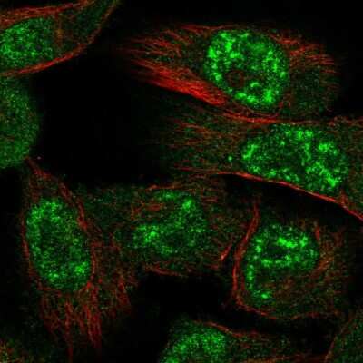 Immunocytochemistry/ Immunofluorescence: AMPK alpha 1 Antibody [NBP2-58302]