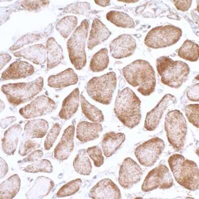 Immunohistochemistry: AMPK alpha 1 Antibody [NB100-239]