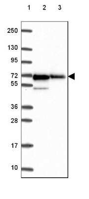 Western Blot: AMPK alpha 1 Antibody [NBP2-49430]