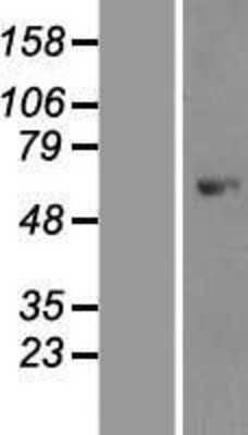 Western Blot: AMPK alpha 1 Overexpression Lysate [NBP2-10421]