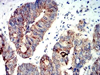 Immunohistochemistry: AMPK alpha 2 Antibody (5B4G1) - BSA Free [NBP2-61853]