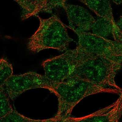 Immunocytochemistry/ Immunofluorescence: AMPK alpha 2 Antibody [NBP2-38532]