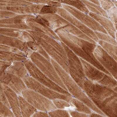 Immunohistochemistry-Paraffin: AMPK alpha 2 Antibody [NBP2-38532]