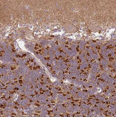 Immunohistochemistry-Paraffin: AMPK alpha 2 Antibody [NBP2-38532]