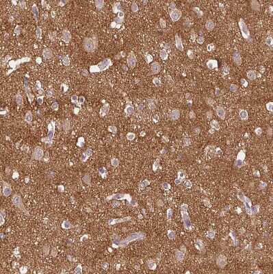 Immunohistochemistry-Paraffin: AMPK alpha 2 Antibody [NBP2-38532]