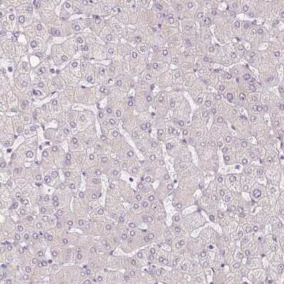 Immunohistochemistry-Paraffin: AMPK alpha 2 Antibody [NBP2-38532]