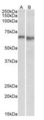 Western Blot: AMPK alpha 2 Antibody [NBP1-49859]