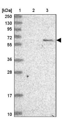 Western Blot: AMPK alpha 2 Antibody [NBP2-38532]