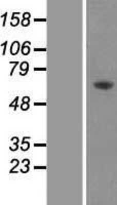 Western Blot: AMPK alpha 2 Overexpression Lysate [NBP2-10422]