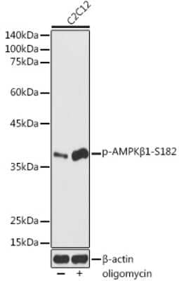 Western Blot: AMPK beta 1 [p Ser182] AntibodyAzide and BSA Free [NBP3-16943]