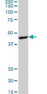 Western Blot: AMPK beta 1 Antibody (1D3) [H00005564-M07]