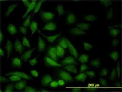 Immunocytochemistry/ Immunofluorescence: AMPK beta 1 Antibody (2C3) [H00005564-M02]