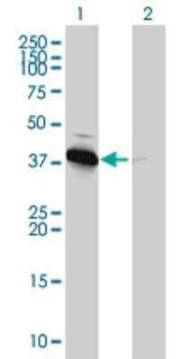 Western Blot: AMPK beta 1 Antibody (3H12-1A10) [H00005564-M01]