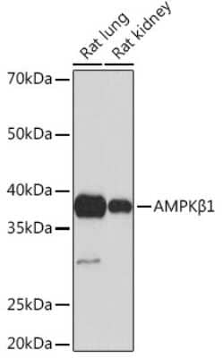 Western Blot: AMPK beta 1 Antibody (7G8U1) [NBP3-16380]