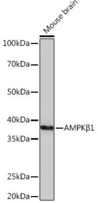 Western Blot: AMPK beta 1 Antibody (7G8U1) [NBP3-16380]
