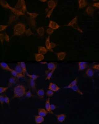 Immunocytochemistry/ Immunofluorescence: AMPK beta 1 Antibody - BSA Free [NBP2-92961]