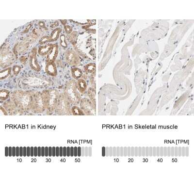 Immunohistochemistry-Paraffin: AMPK beta 1 Antibody [NBP1-87487]