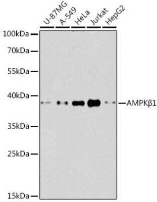 Western Blot: AMPK beta 1 AntibodyBSA Free [NBP2-92961]