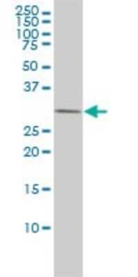 Western Blot: AMPK beta 2/PRKAB2 Antibody (2G9) [H00005565-M01]