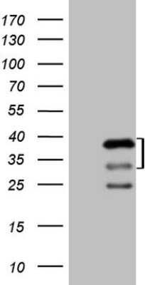 Western Blot: AMPK beta 2/PRKAB2 Antibody (OTI4H4) [NBP2-45389]