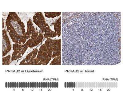 Immunohistochemistry-Paraffin: AMPK beta 2/PRKAB2 Antibody [NBP1-92286]