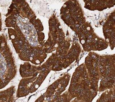 Immunohistochemistry-Paraffin: AMPK beta 2/PRKAB2 Antibody [NBP1-92286]