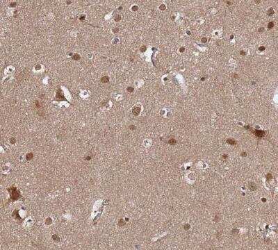 Immunohistochemistry-Paraffin: AMPK beta 2/PRKAB2 Antibody [NBP1-92286]