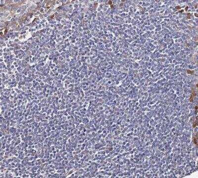 Immunohistochemistry-Paraffin: AMPK beta 2/PRKAB2 Antibody [NBP1-92286]