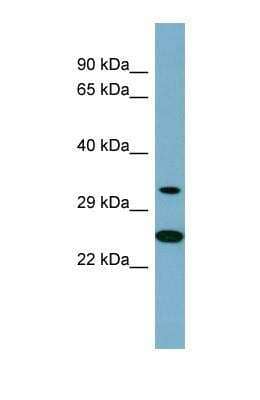 Western Blot: AMPK beta 2/PRKAB2 Antibody [NBP1-57581]