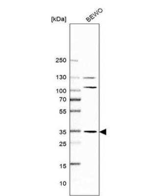 Western Blot: AMPK beta 2/PRKAB2 Antibody [NBP1-92286]