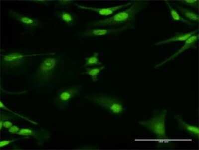 Immunocytochemistry/ Immunofluorescence: AMPK gamma 1 Antibody [H00005571-D01P]