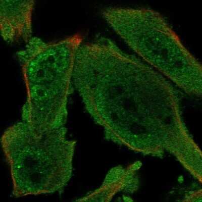 Immunocytochemistry/ Immunofluorescence: AMPK gamma 1 Antibody [NBP2-57986]