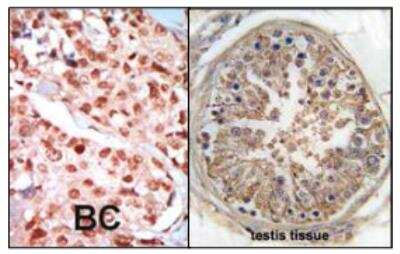 Immunohistochemistry-Paraffin: AMPK gamma 1 Antibody [NBP1-50668]