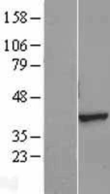 Western Blot: AMPK gamma 1 Overexpression Lysate [NBL1-14759]