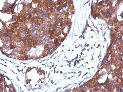 Immunohistochemistry-Paraffin: AMSH/STAMBP Antibody [NBP2-15383]