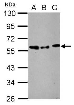 Western Blot: AMSH/STAMBP Antibody [NBP2-15383]