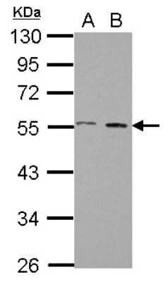 Western Blot: AMSH/STAMBP Antibody [NBP2-15383]