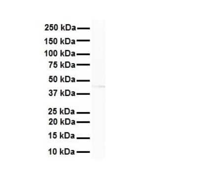 Western Blot: AMSH-LP Antibody [NBP2-86993]