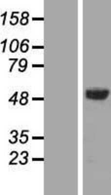 Western Blot: AMSH/STAMBP Overexpression Lysate [NBL1-16512]