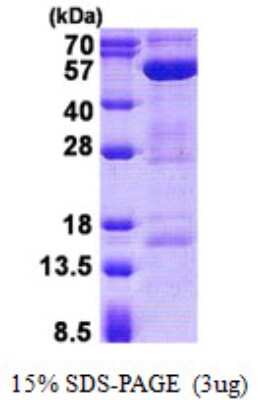 SDS-PAGE: Recombinant Human AMSH/STAMBP His Protein [NBP2-22825]