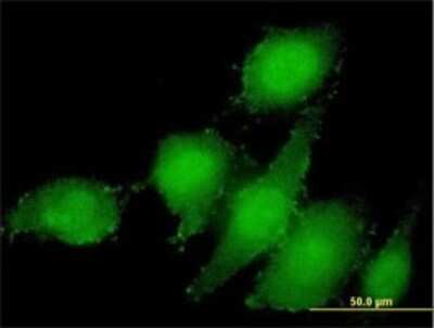 Immunocytochemistry/ Immunofluorescence: AMSH/STAMBP Antibody (1A8) [H00010617-M01]