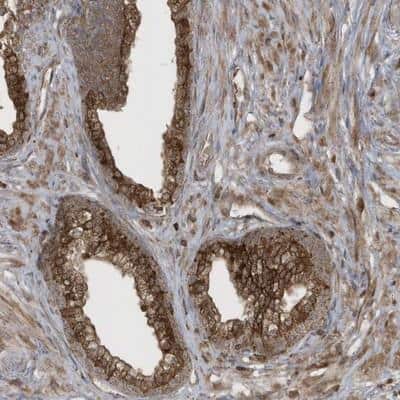 Immunohistochemistry-Paraffin: AMSH/STAMBP Antibody [NBP1-90172]