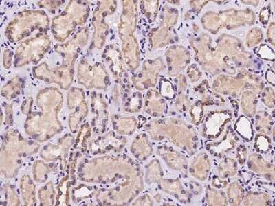 Immunohistochemistry-Paraffin: AMSH/STAMBP Antibody [NBP2-97315]