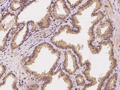 Immunohistochemistry-Paraffin: AMSH/STAMBP Antibody [NBP2-97315]