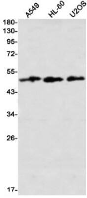 Western Blot: AMSH/STAMBP Antibody (S07-6D1) [NBP3-19832]